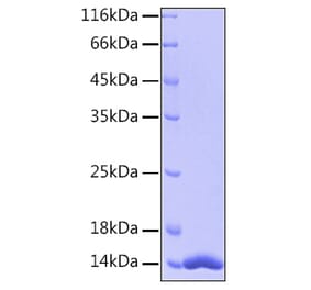 SDS-PAGE - Recombinant Human FABP4 Protein (A330603) - Antibodies.com