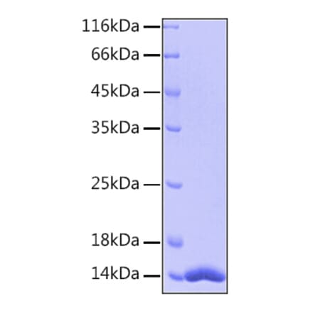 SDS-PAGE - Recombinant Human FABP4 Protein (A330603) - Antibodies.com