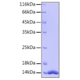 SDS-PAGE - Recombinant Human FABP4 Protein (A330603) - Antibodies.com