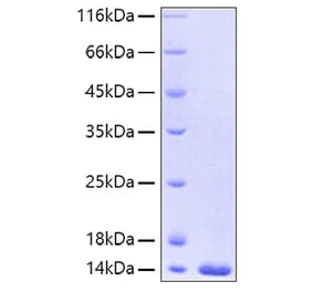SDS-PAGE - Recombinant Human FABP4 Protein (A330604) - Antibodies.com