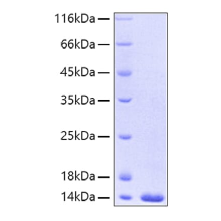 SDS-PAGE - Recombinant Human FABP4 Protein (A330604) - Antibodies.com