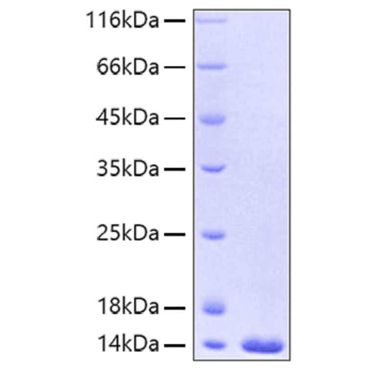 SDS-PAGE - Recombinant Human FABP4 Protein (A330604) - Antibodies.com