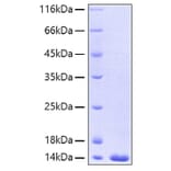 SDS-PAGE - Recombinant Human FABP4 Protein (A330604) - Antibodies.com
