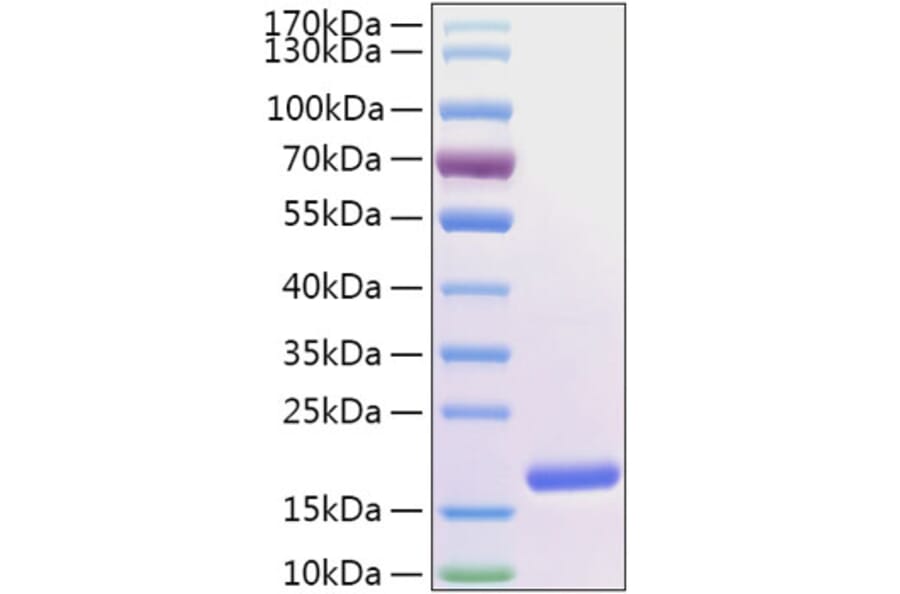 SDS-PAGE - Recombinant Human FABP5 Protein (N-terminal His Tag) (A330605) - Antibodies.com