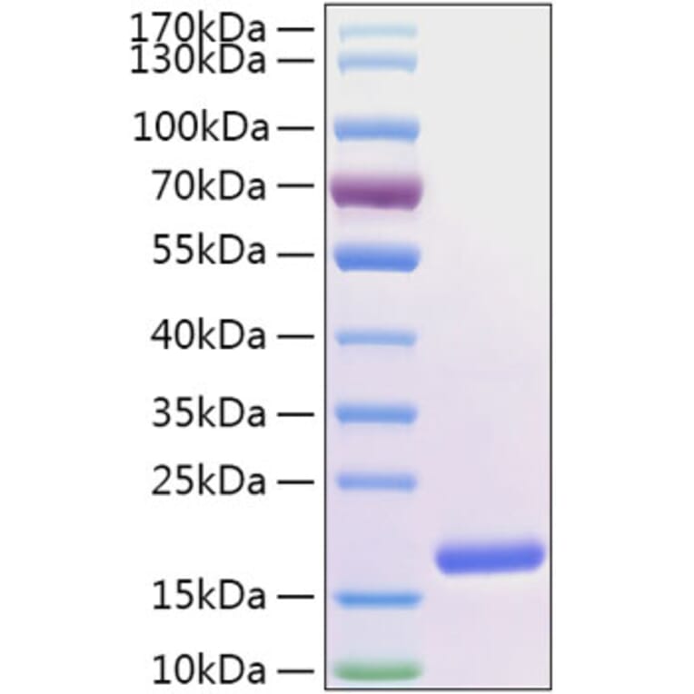 SDS-PAGE - Recombinant Human FABP5 Protein (N-terminal His Tag) (A330605) - Antibodies.com