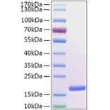 SDS-PAGE - Recombinant Human FABP5 Protein (N-terminal His Tag) (A330605) - Antibodies.com