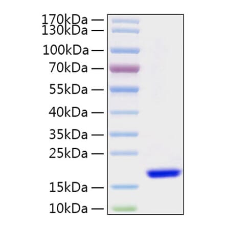 SDS-PAGE - Recombinant Human FABP7 Protein (N-terminal His Tag) (A330606) - Antibodies.com