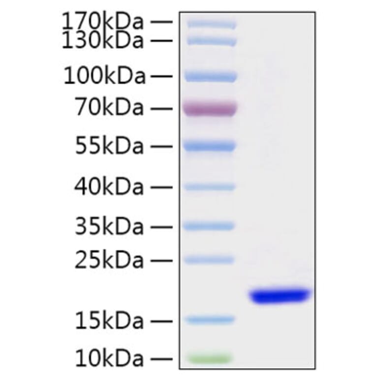 SDS-PAGE - Recombinant Human FABP7 Protein (N-terminal His Tag) (A330606) - Antibodies.com