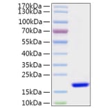 SDS-PAGE - Recombinant Human FABP7 Protein (N-terminal His Tag) (A330606) - Antibodies.com