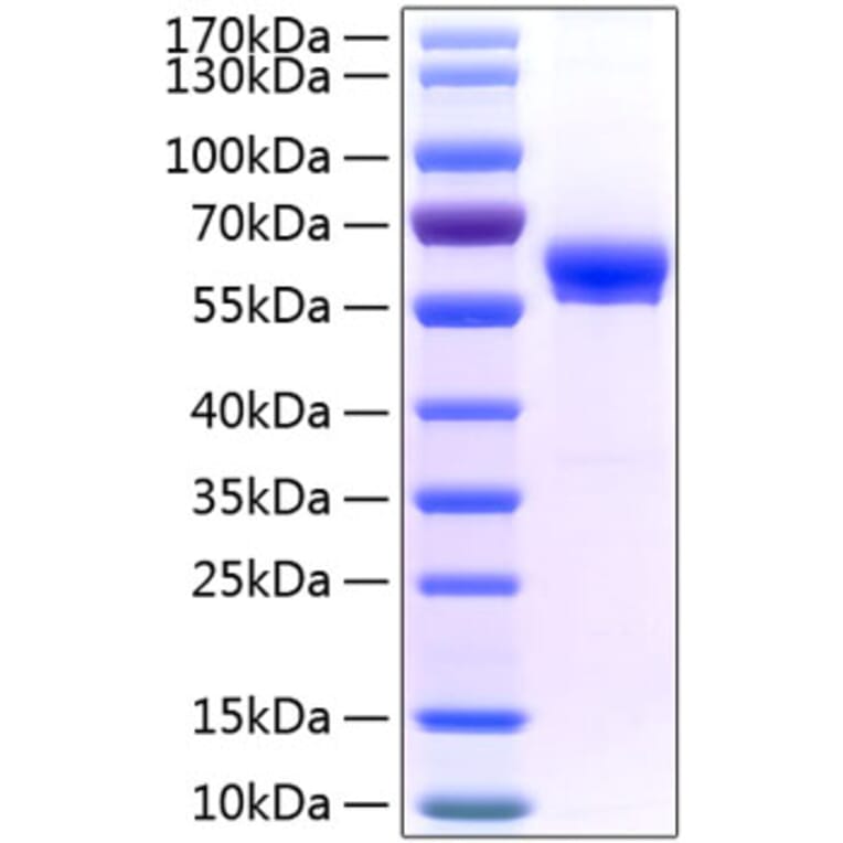 SDS-PAGE - Recombinant Human FAM3B Protein (C-terminal Fc Tag) (A330607) - Antibodies.com