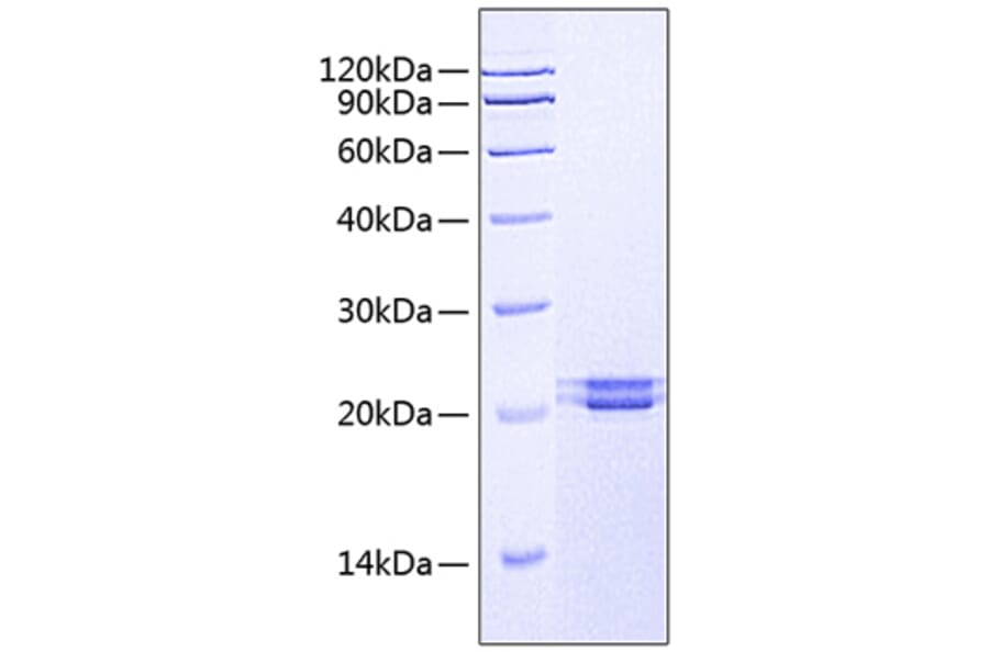 SDS-PAGE - Recombinant Human FAM3C/ILEI Protein (C-terminal His Tag) (A330608) - Antibodies.com