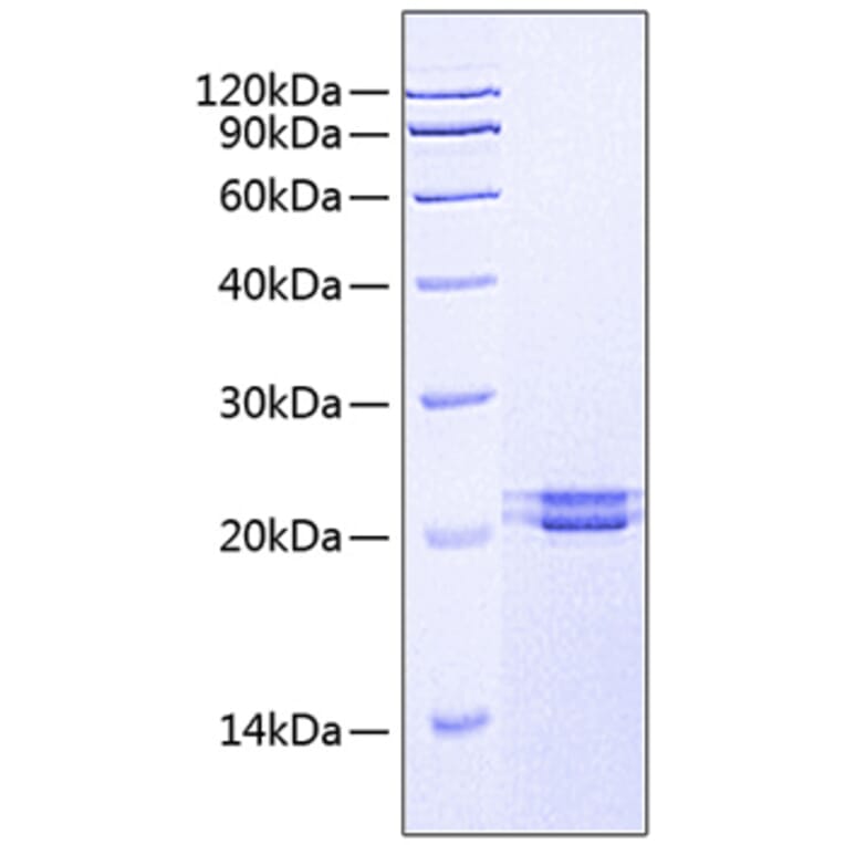 SDS-PAGE - Recombinant Human FAM3C/ILEI Protein (C-terminal His Tag) (A330608) - Antibodies.com