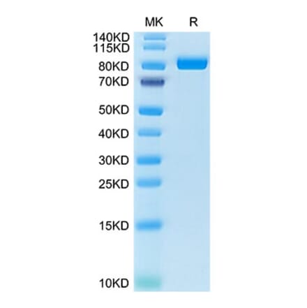 Tris-Bis PAGE - Recombinant Cynomolgus macaque FAP Protein (N-terminal His Tag) (A330609) - Antibodies.com