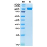 Tris-Bis PAGE - Recombinant Cynomolgus macaque FAP Protein (N-terminal His Tag) (A330609) - Antibodies.com
