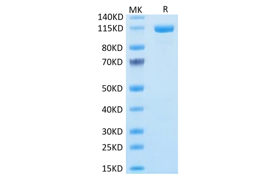 Tris-Bis PAGE - Recombinant Human FAP Protein (N-terminal Human Fc Tag) (A330610) - Antibodies.com