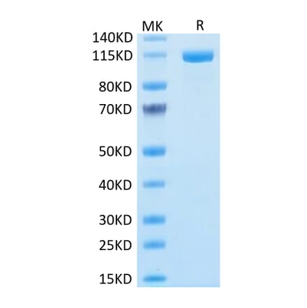 Tris-Bis PAGE - Recombinant Human FAP Protein (N-terminal Human Fc Tag) (A330610) - Antibodies.com
