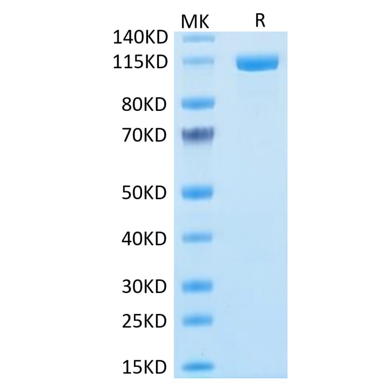 Tris-Bis PAGE - Recombinant Human FAP Protein (N-terminal Human Fc Tag) (A330610) - Antibodies.com