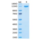 Tris-Bis PAGE - Recombinant Human FAP Protein (N-terminal Human Fc Tag) (A330610) - Antibodies.com