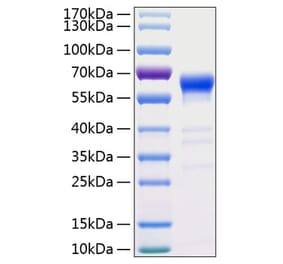 SDS-PAGE - Recombinant Human Fas Protein (C-terminal Human Fc and His Tag) (A330612) - Antibodies.com
