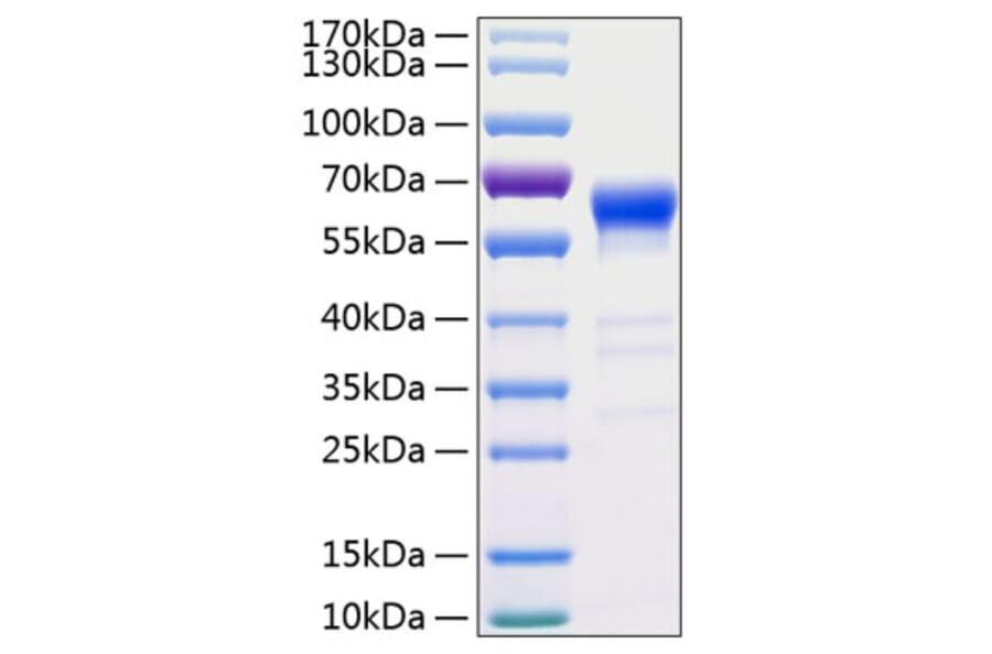 SDS-PAGE - Recombinant Human Fas Protein (C-terminal Human Fc and His Tag) (A330612) - Antibodies.com