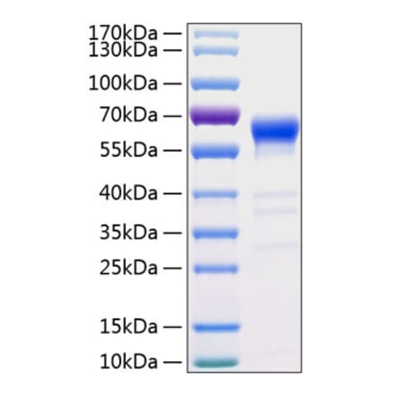 SDS-PAGE - Recombinant Human Fas Protein (C-terminal Human Fc and His Tag) (A330612) - Antibodies.com