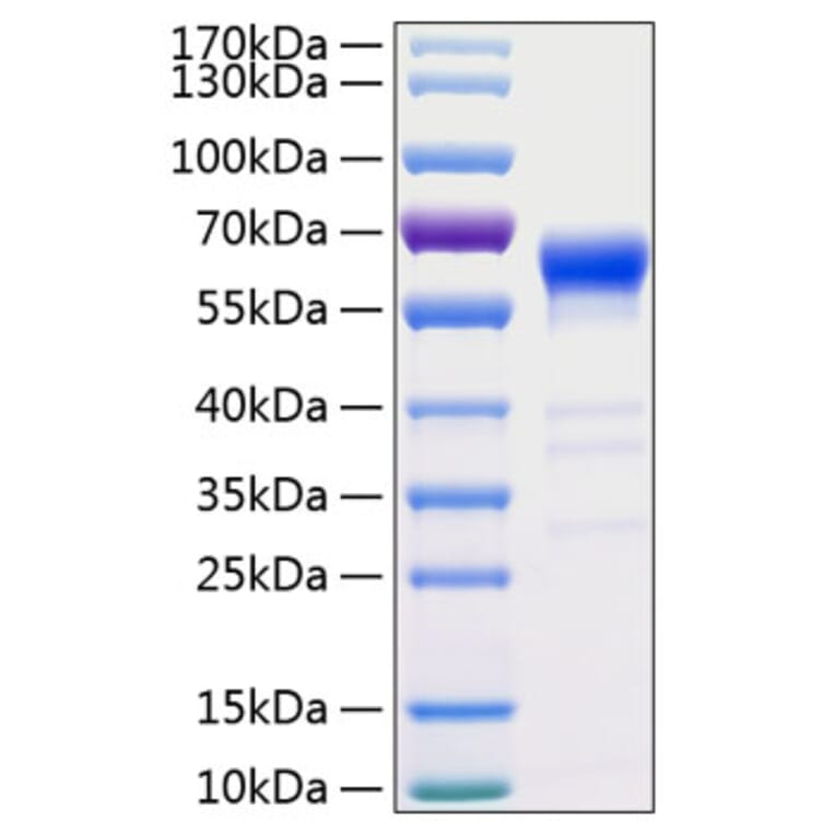 SDS-PAGE - Recombinant Human Fas Protein (C-terminal Human Fc and His Tag) (A330612) - Antibodies.com