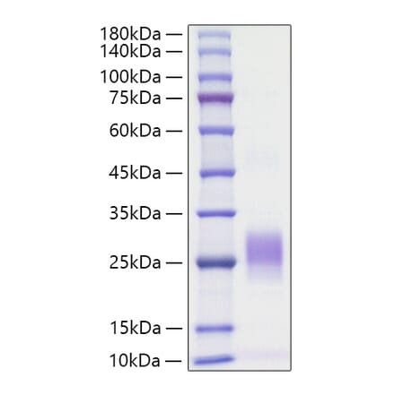 SDS-PAGE - Recombinant Human Fas Ligand Protein (N-terminal His Tag) (A330613) - Antibodies.com