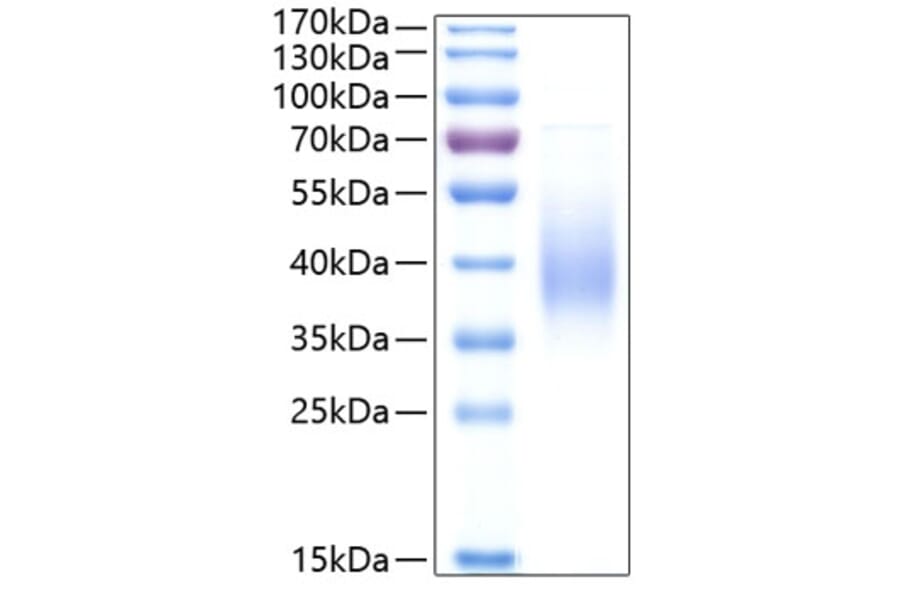 SDS-PAGE - Recombinant Human Fc epsilon RI/FCER1A Protein (C-terminal His Tag) (A330614) - Antibodies.com