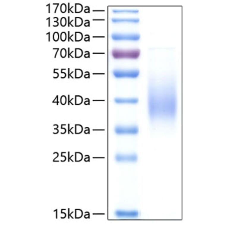 SDS-PAGE - Recombinant Human Fc epsilon RI/FCER1A Protein (C-terminal His Tag) (A330614) - Antibodies.com