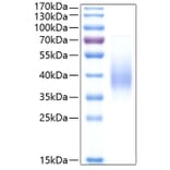 SDS-PAGE - Recombinant Human Fc epsilon RI/FCER1A Protein (C-terminal His Tag) (A330614) - Antibodies.com