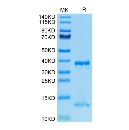 Tris-Bis PAGE - Recombinant Human FcRn Protein (C-terminal His Tag) (A330616) - Antibodies.com