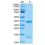 Tris-Bis PAGE - Recombinant Human FcRn Protein (C-terminal His Tag) (A330616) - Antibodies.com