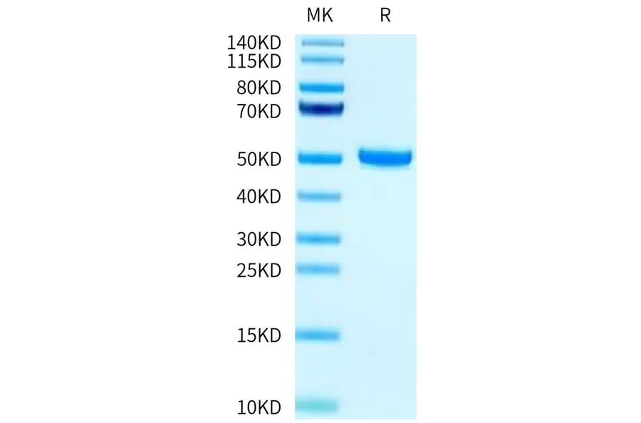 Tris-Bis PAGE - Recombinant Human FcRn + beta 2 Microglobulin Protein (Biotin) (C-terminal His and Avi Tag) (A330618) - Antibodies.com