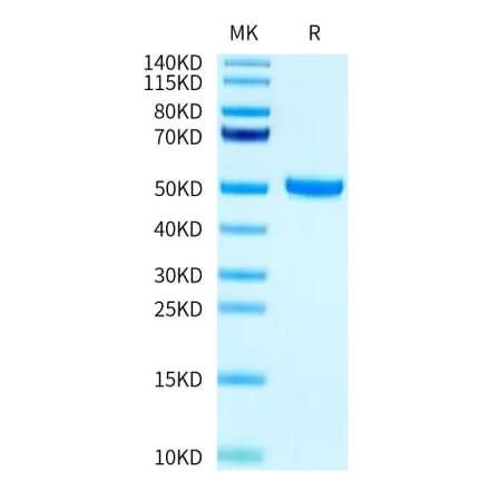 Tris-Bis PAGE - Recombinant Human FcRn + beta 2 Microglobulin Protein (Biotin) (C-terminal His and Avi Tag) (A330618) - Antibodies.com