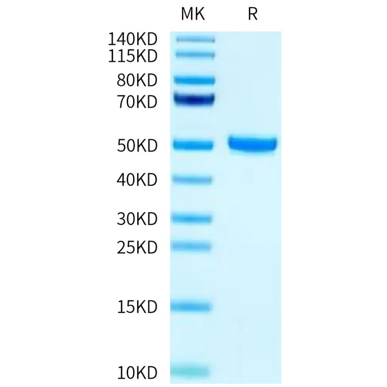 Tris-Bis PAGE - Recombinant Human FcRn + beta 2 Microglobulin Protein (Biotin) (C-terminal His and Avi Tag) (A330618) - Antibodies.com