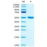Tris-Bis PAGE - Recombinant Human FcRn + beta 2 Microglobulin Protein (Biotin) (C-terminal His and Avi Tag) (A330618) - Antibodies.com
