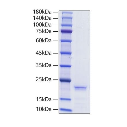 SDS-PAGE - Recombinant Human Ferritin Protein (A330619) - Antibodies.com