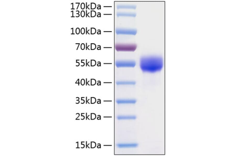 SDS-PAGE - Recombinant Human Fetuin A Protein (C-terminal His Tag) (A330620) - Antibodies.com