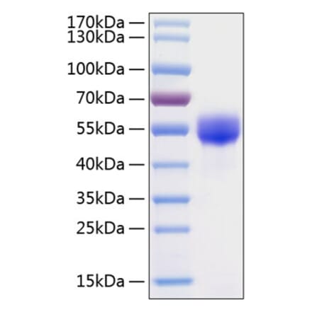 SDS-PAGE - Recombinant Human Fetuin A Protein (C-terminal His Tag) (A330620) - Antibodies.com
