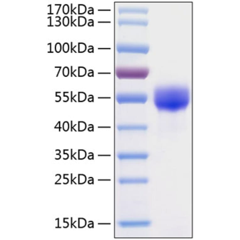 SDS-PAGE - Recombinant Human Fetuin A Protein (C-terminal His Tag) (A330620) - Antibodies.com