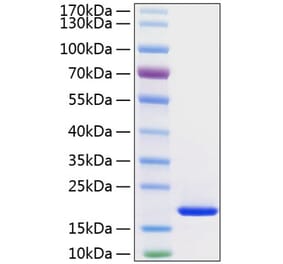 SDS-PAGE - Recombinant Human FGF1 Protein (C-terminal His Tag) (A330621) - Antibodies.com