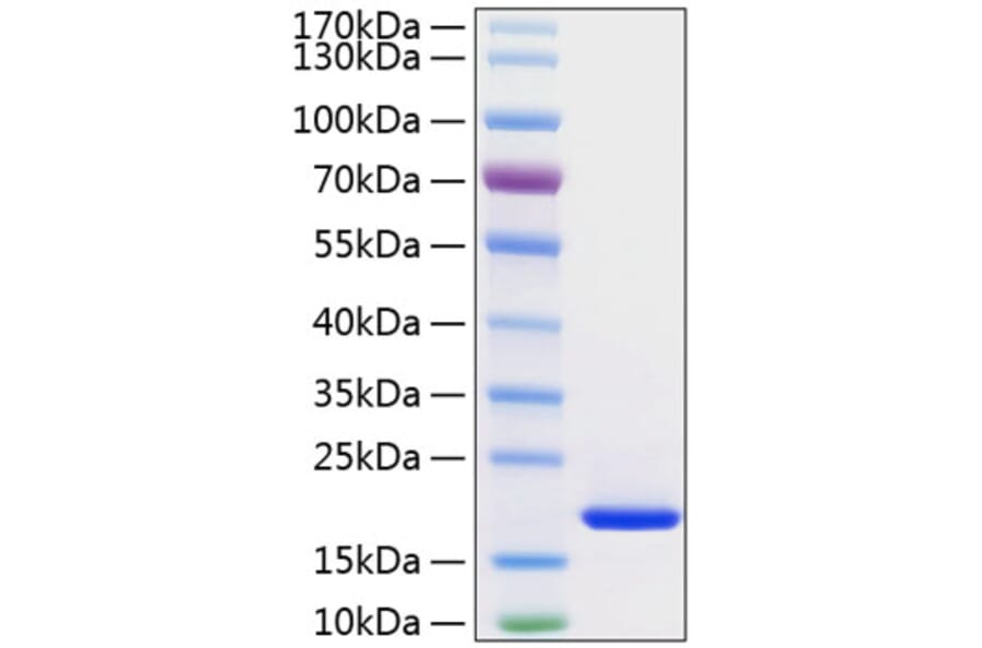 SDS-PAGE - Recombinant Human FGF1 Protein (C-terminal His Tag) (A330621) - Antibodies.com