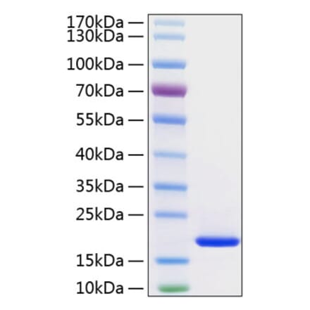 SDS-PAGE - Recombinant Human FGF1 Protein (C-terminal His Tag) (A330621) - Antibodies.com