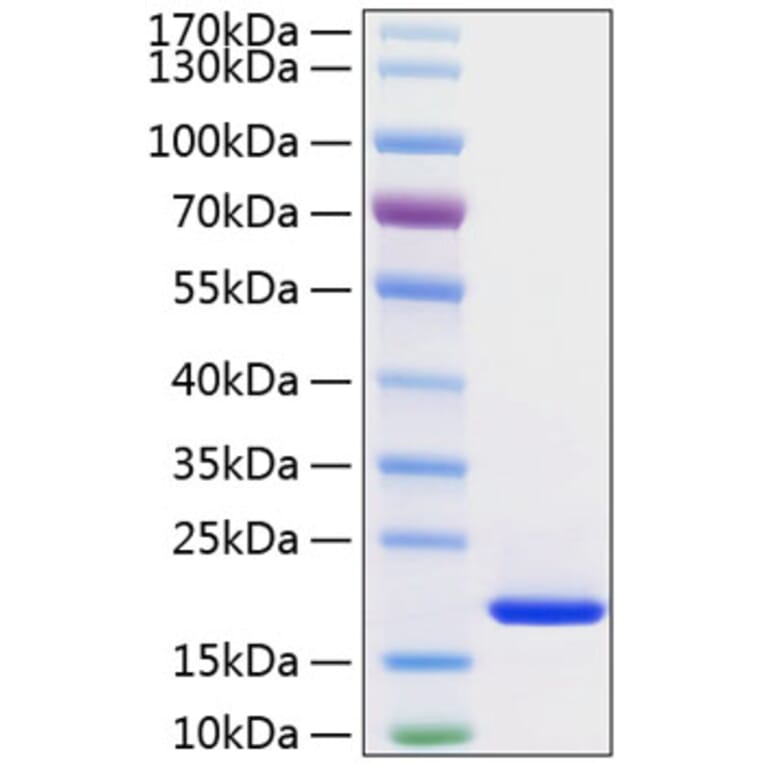 SDS-PAGE - Recombinant Human FGF1 Protein (C-terminal His Tag) (A330621) - Antibodies.com