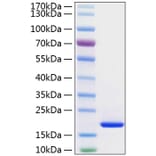 SDS-PAGE - Recombinant Human FGF1 Protein (C-terminal His Tag) (A330621) - Antibodies.com