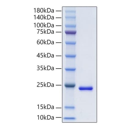 SDS-PAGE - Recombinant Human FGF10 Protein (A330622) - Antibodies.com