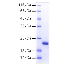SDS-PAGE - Recombinant Human FGF12 Protein (C-terminal His Tag) (A330623) - Antibodies.com