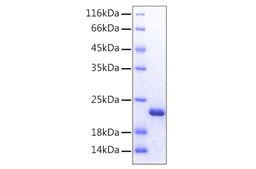 SDS-PAGE - Recombinant Human FGF12 Protein (C-terminal His Tag) (A330623) - Antibodies.com