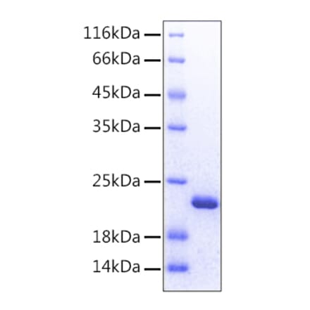 SDS-PAGE - Recombinant Human FGF12 Protein (C-terminal His Tag) (A330623) - Antibodies.com