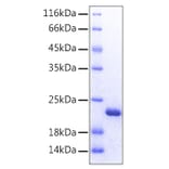SDS-PAGE - Recombinant Human FGF12 Protein (C-terminal His Tag) (A330623) - Antibodies.com